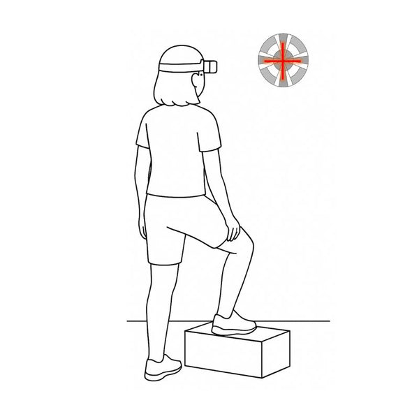 Position illustration: Step-Up Fixation
